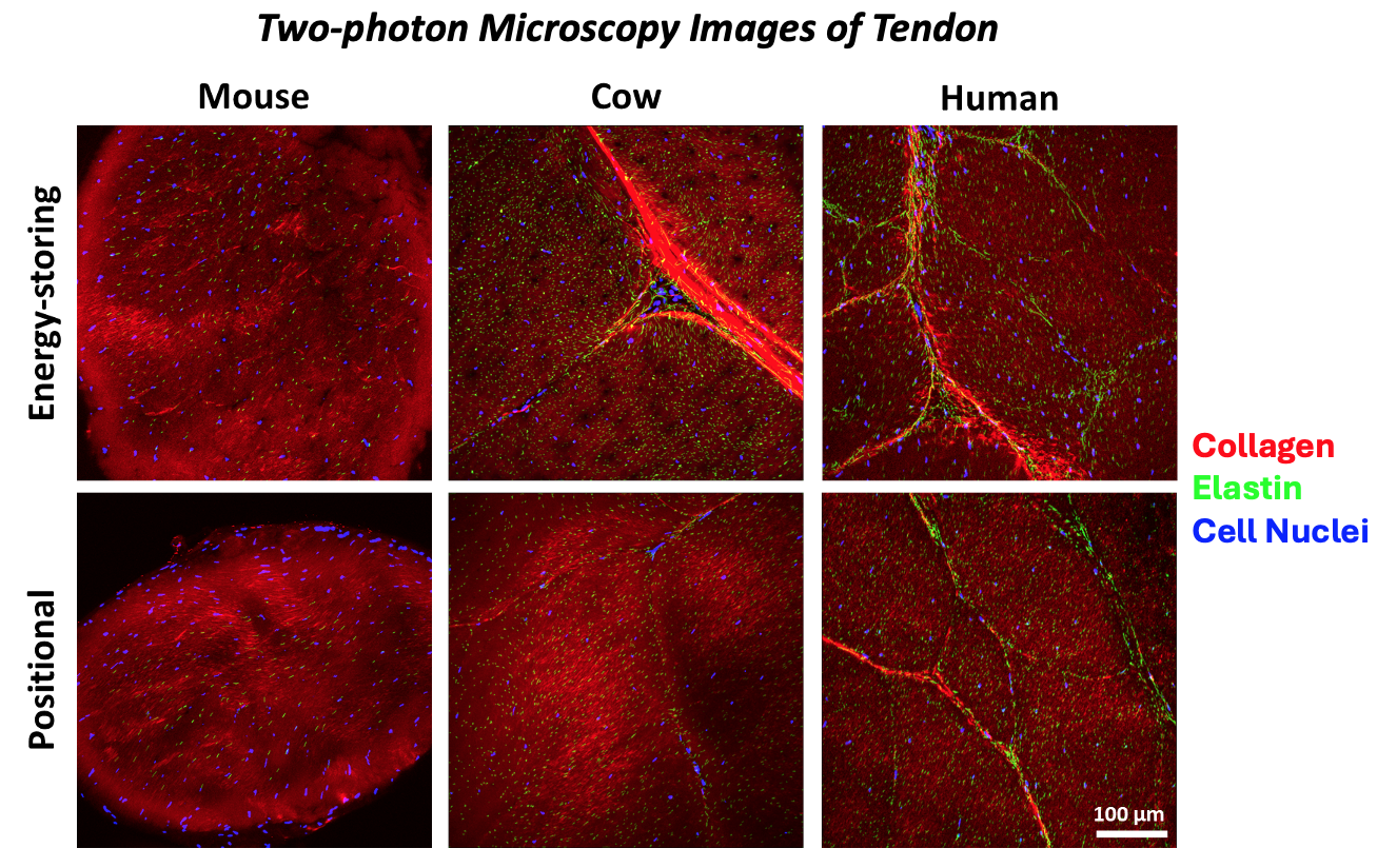 Tendon images