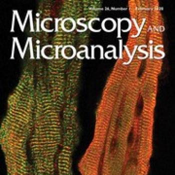 Microscopy and Analysis